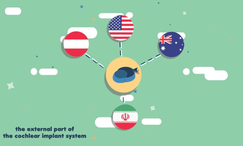 cochlear implantation